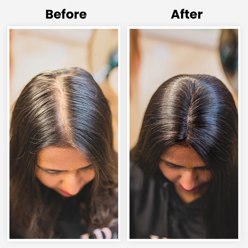 Scalp Topper Hair Extensions For Women | Silk base & 100% Human Hair