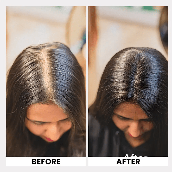 Lace Topper Hair Extensions | Backcombed Hair Topper- Crown Area For Hair Thinning