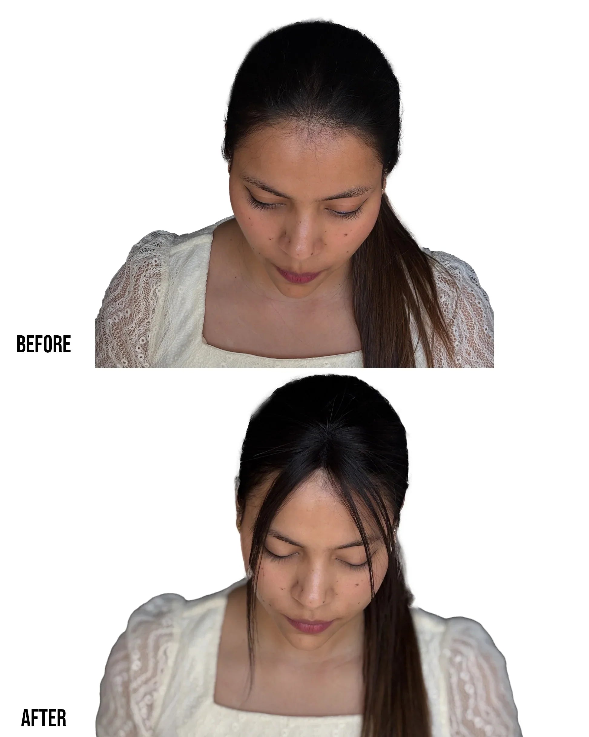 Front Hair Thinning Cover Up Patch | 2.5x1.5 | Natural Hairline & Forehead Coverage Patch